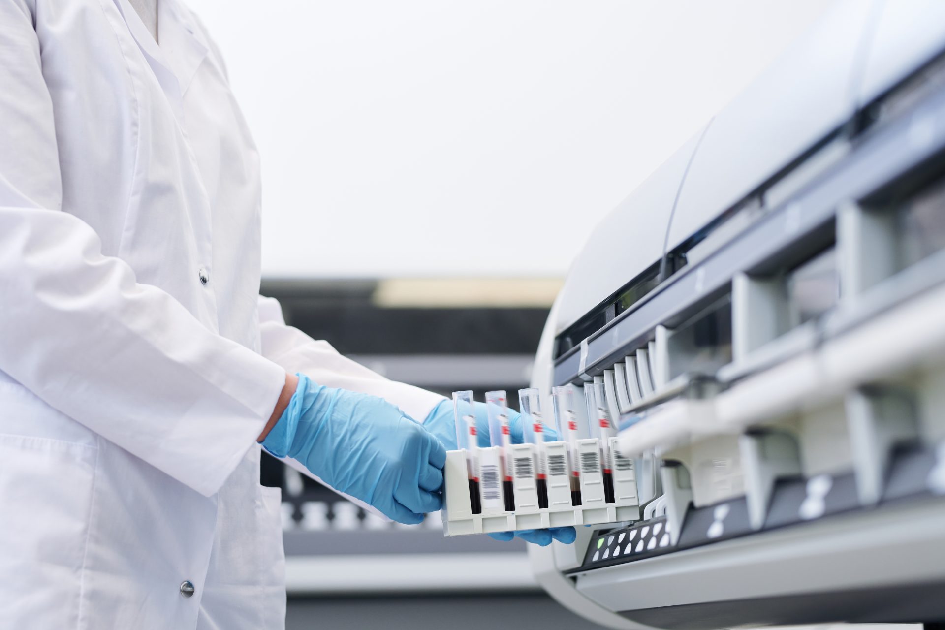 Técnico manipulando muestras con equipo de laboratorio automatizado